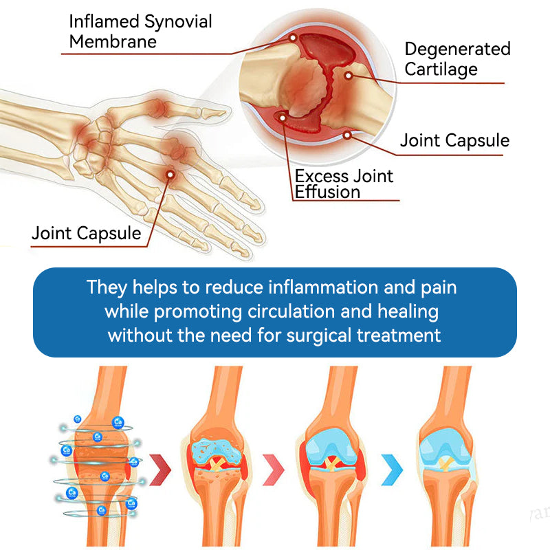 LOVILDS® 𝐁𝐏𝐂-𝟏𝟓𝟕 𝐉𝐨𝐢𝐧𝐭 𝐇𝐞𝐚𝐥𝐢𝐧𝐠 𝐂𝐫𝐞𝐚𝐦 𝐓𝐫𝐞𝐚𝐭𝐬 𝐀𝐫𝐭𝐡𝐫𝐢𝐭𝐢𝐬, 𝐍𝐞𝐮𝐫𝐨𝐩𝐚𝐭𝐡𝐲, 𝐑𝐡𝐞𝐮𝐦𝐚𝐭𝐢𝐬𝐦, 𝐒𝐩𝐨𝐫𝐭𝐬 𝐈𝐧𝐣𝐮𝐫𝐢𝐞𝐬 & 𝐌𝐨𝐫𝐞