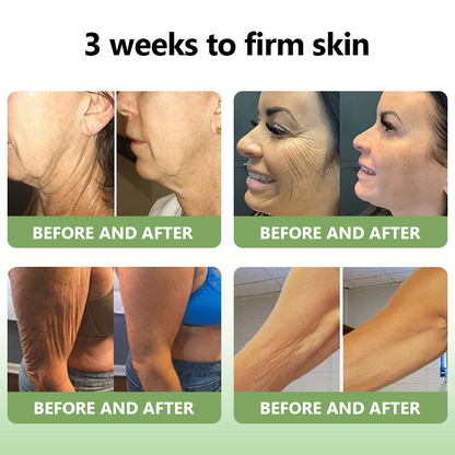 【 ✨Official Brand Store ✨】LOVILDS™ 𝐋𝐮𝐱𝐮𝐫𝐢𝐨𝐮𝐬 𝐂𝐨𝐥𝐥𝐚𝐠𝐞𝐧 𝐅𝐢𝐫𝐦𝐢𝐧𝐠 𝐂𝐫𝐞𝐚𝐦