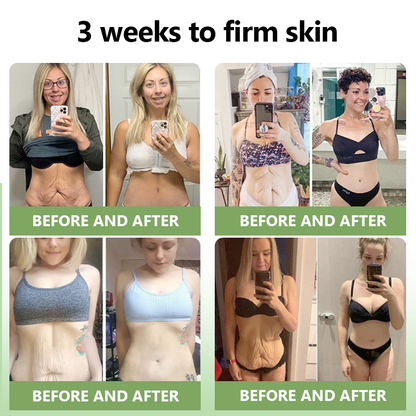 【 ✨Official Brand Store ✨】LOVILDS™ 𝐋𝐮𝐱𝐮𝐫𝐢𝐨𝐮𝐬 𝐂𝐨𝐥𝐥𝐚𝐠𝐞𝐧 𝐅𝐢𝐫𝐦𝐢𝐧𝐠 𝐂𝐫𝐞𝐚𝐦