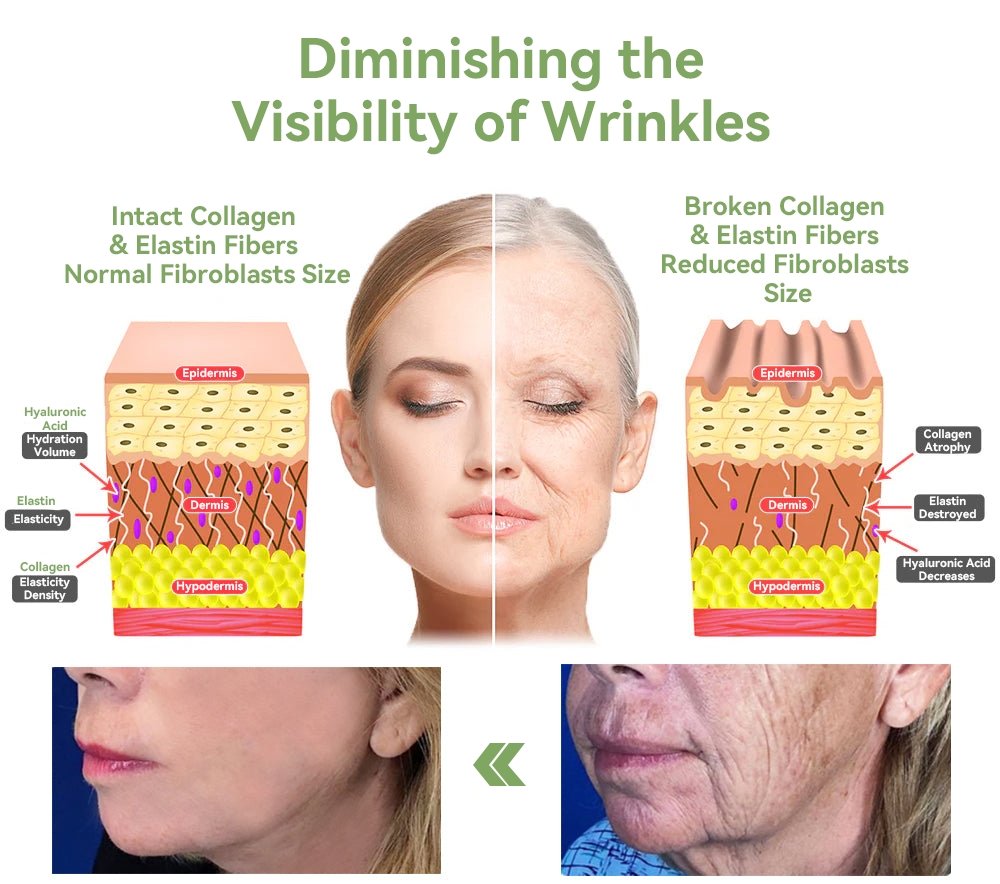 【 ✨Official Brand Store ✨】LOVILDS™ 𝐋𝐮𝐱𝐮𝐫𝐢𝐨𝐮𝐬 𝐂𝐨𝐥𝐥𝐚𝐠𝐞𝐧 𝐅𝐢𝐫𝐦𝐢𝐧𝐠 𝐂𝐫𝐞𝐚𝐦