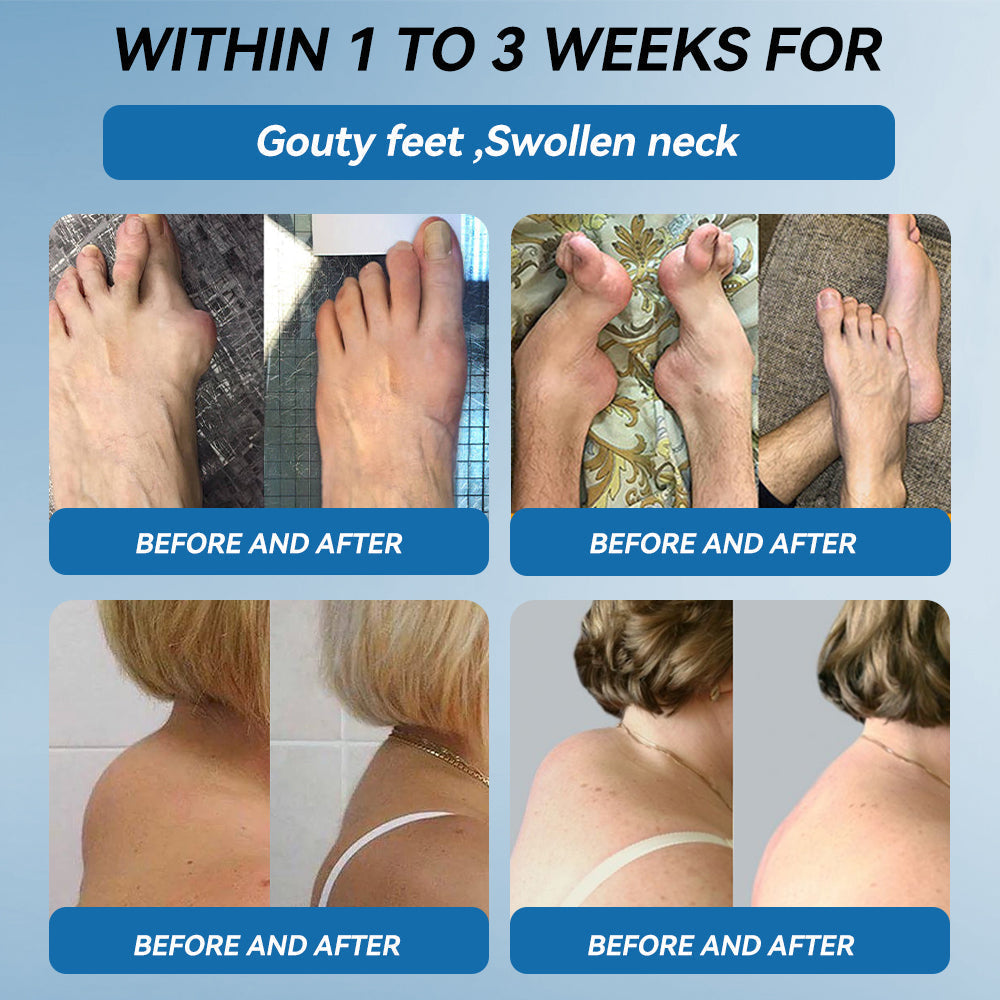 LOVILDS® 𝐁𝐏𝐂-𝟏𝟓𝟕 𝐉𝐨𝐢𝐧𝐭 𝐇𝐞𝐚𝐥𝐢𝐧𝐠 𝐂𝐫𝐞𝐚𝐦 𝐓𝐫𝐞𝐚𝐭𝐬 𝐀𝐫𝐭𝐡𝐫𝐢𝐭𝐢𝐬, 𝐍𝐞𝐮𝐫𝐨𝐩𝐚𝐭𝐡𝐲, 𝐑𝐡𝐞𝐮𝐦𝐚𝐭𝐢𝐬𝐦, 𝐒𝐩𝐨𝐫𝐭𝐬 𝐈𝐧𝐣𝐮𝐫𝐢𝐞𝐬 & 𝐌𝐨𝐫𝐞